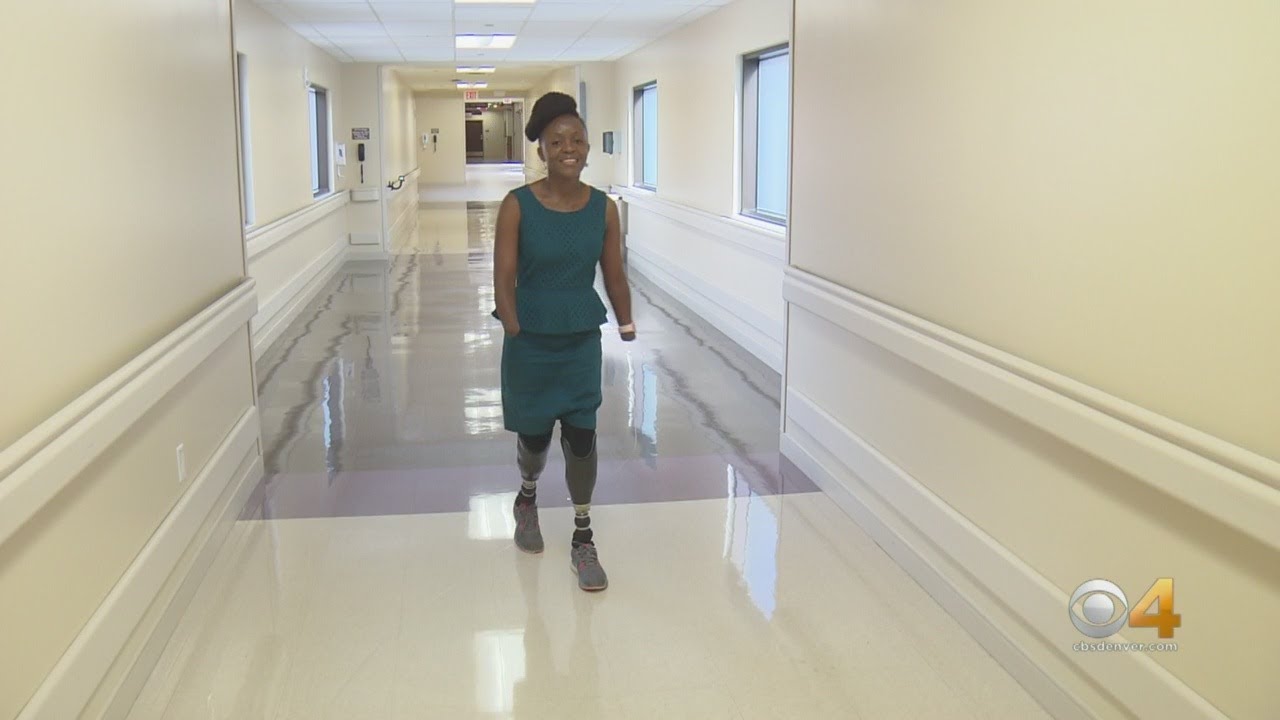 Victoria Mugo Loses Hands, Legs Due To Septic Shock