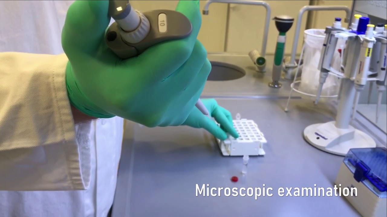 New sperm diagnostics_Infertility_Katerina Komrskova_Institute of Biotechnology CAS, BIOCEV