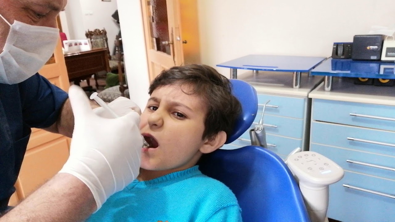 &Ccedil;ocuk Diş &Ccedil;ekimi Nasıl Yapılır? | Diş Hekimi Fikret Altan Diş Kliniği 05423122441
