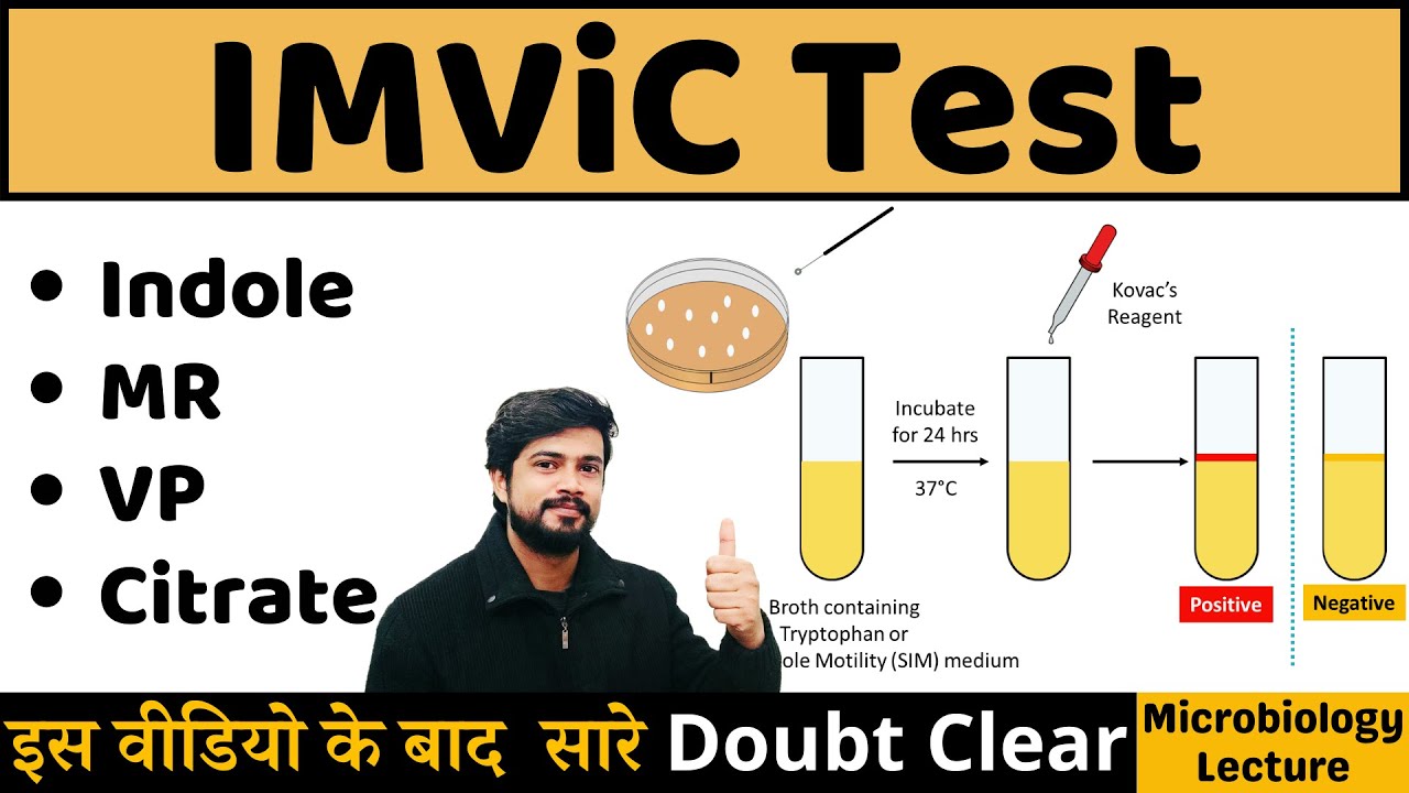 IMViC Test ( Indole, MR, VP, Citrate Utilization Test ) IMViC Test Procedure in  Microbiology
