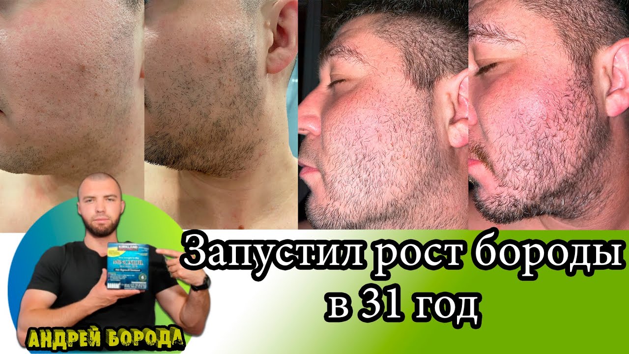 Это запустило рост бороды в 31 год / Выпуск №3 / Андрей борода