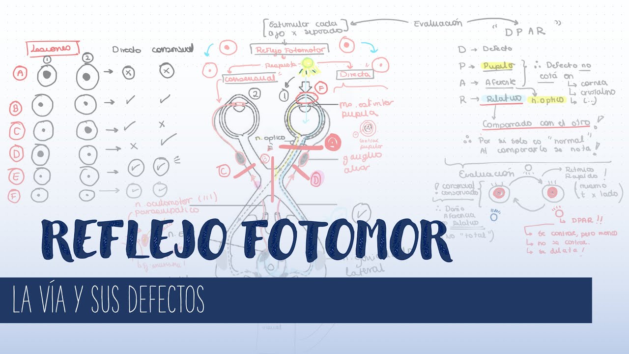 REFLEJO FOTOMOTOR  y DPAR:Defecto Pupilar Aferente Relativo #REFLEJOPUPILAR #DPAR #reflejofotomotor