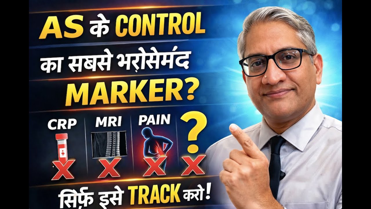 Ankylosing Spondylitis के CONTROL का सबसे भरोसेमंद मार्कर कौनसा है?