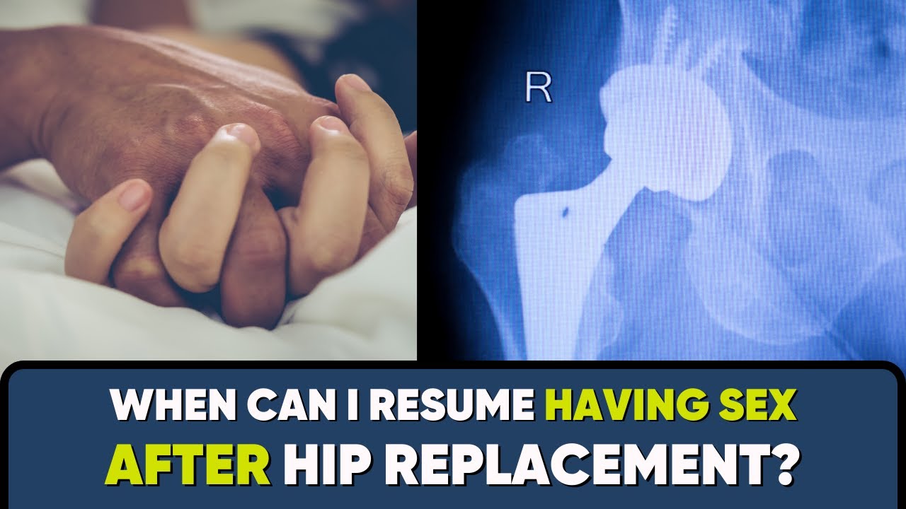 When can I have SEX AFTER Total Hip Replacement Surgery? #hipreplacementrecovery