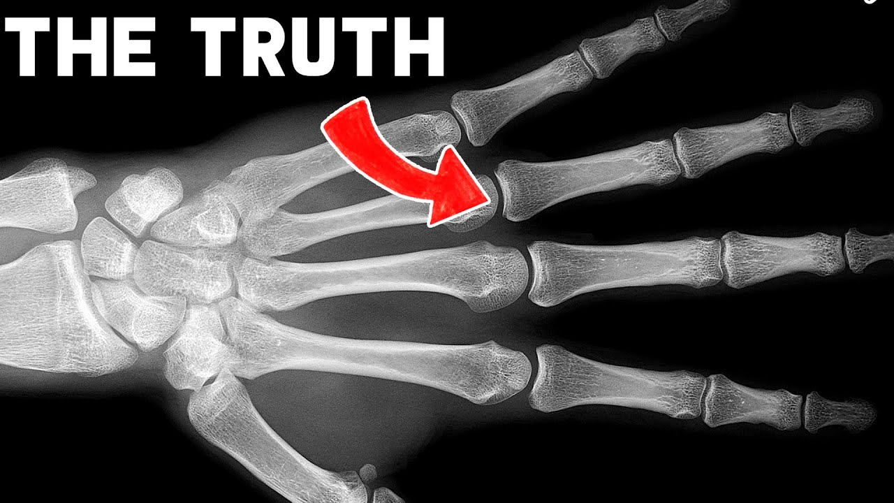 Is cracking your knuckles bad for you? #shorts