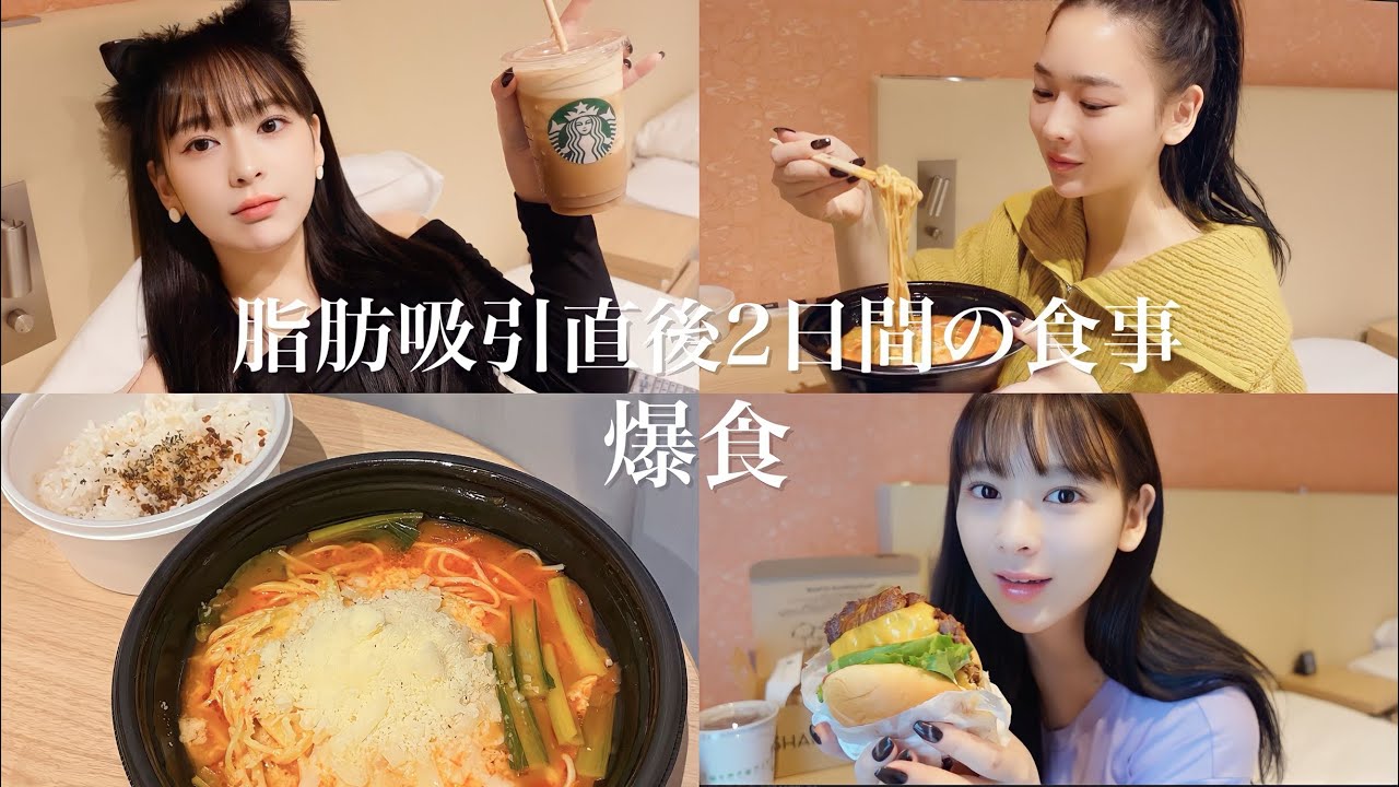 【爆食】ダウンタイム辛すぎるから食べる。脂肪吸引直後の爆食🔥