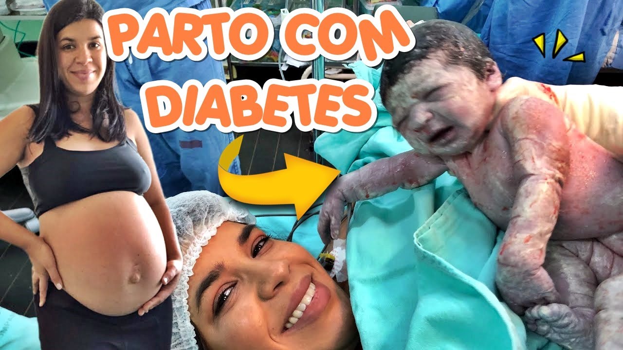 RELATO DE PARTO DE RISCO DA ALANA- DIABETES GESTACIONAL COM USO DE INSULINA
