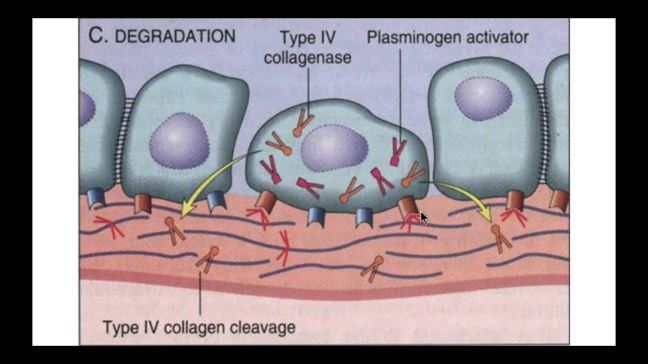 oncologie deel 5 invasie en metastasering