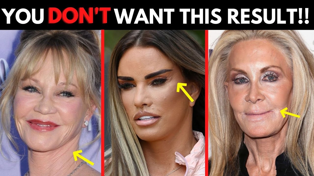 Avoid these HUGE mistakes when looking for a facelift surgeon! How to find the BEST for you!
