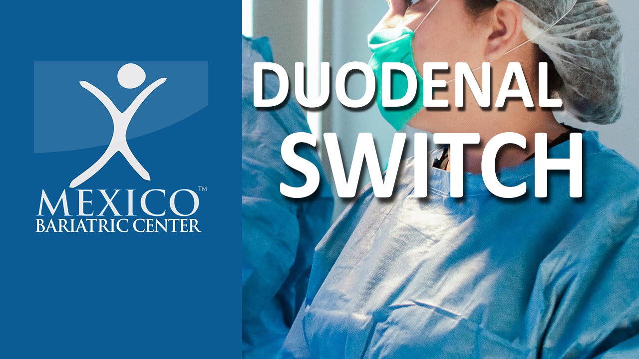 How Duodenal Switch Works | Animation