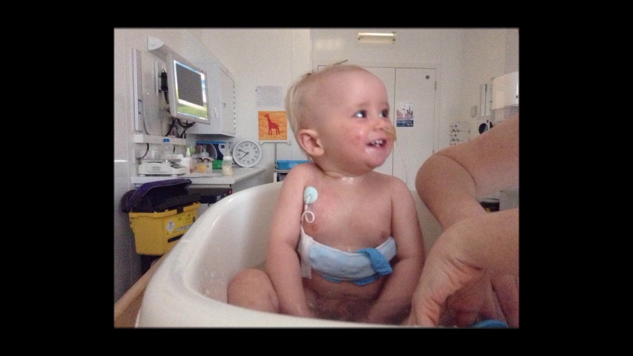 Wiskott Aldrich Syndrome - Primary Immunodeficiency Disease