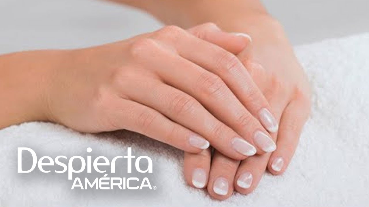 &iquest;Por qu&eacute; se hinchan las manos? El Dr. Juan lo explica y da un remedio natural para aliviarlo | DA