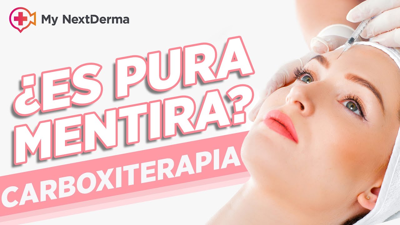 ¡CARBOXITERAPIA! ¿Funciona o es un ROBO TOTAL?