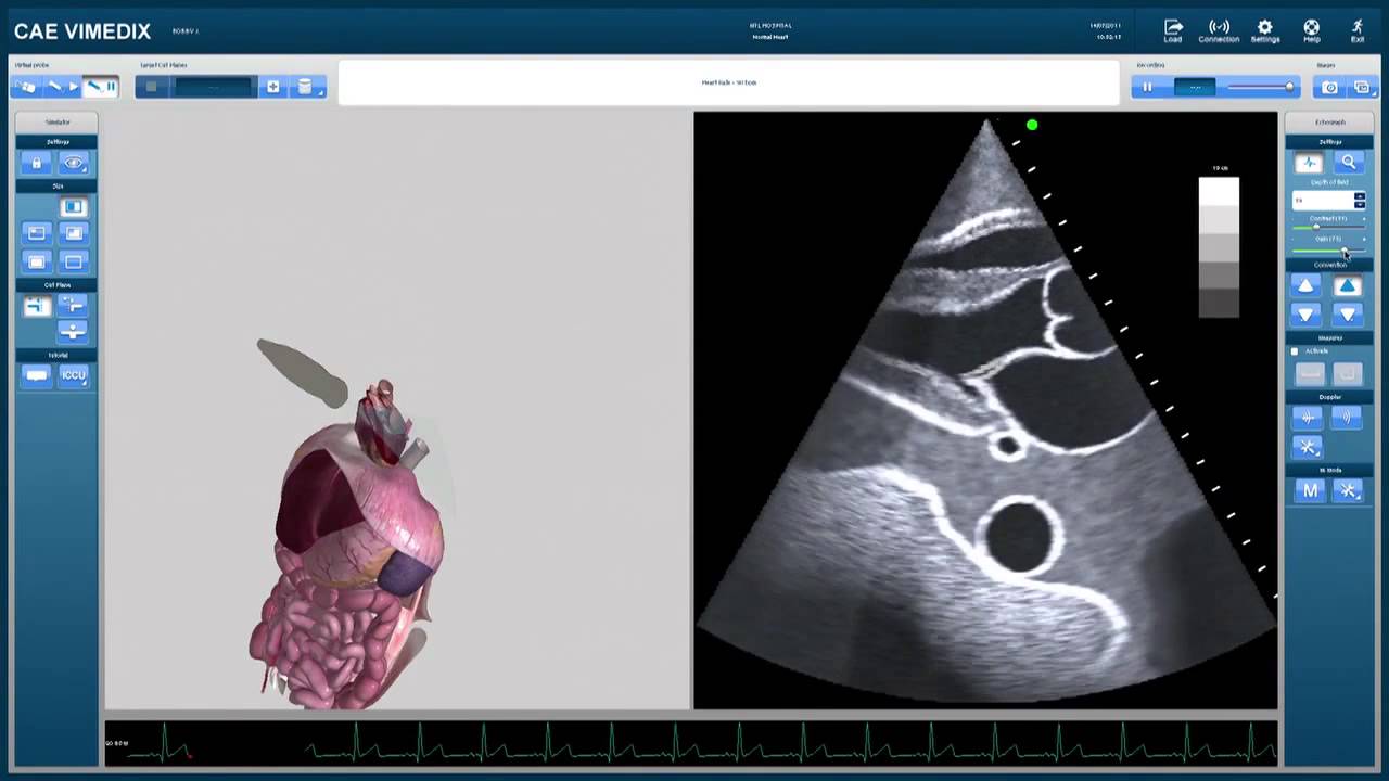 Vimedix Computer Ultrasound Simulator