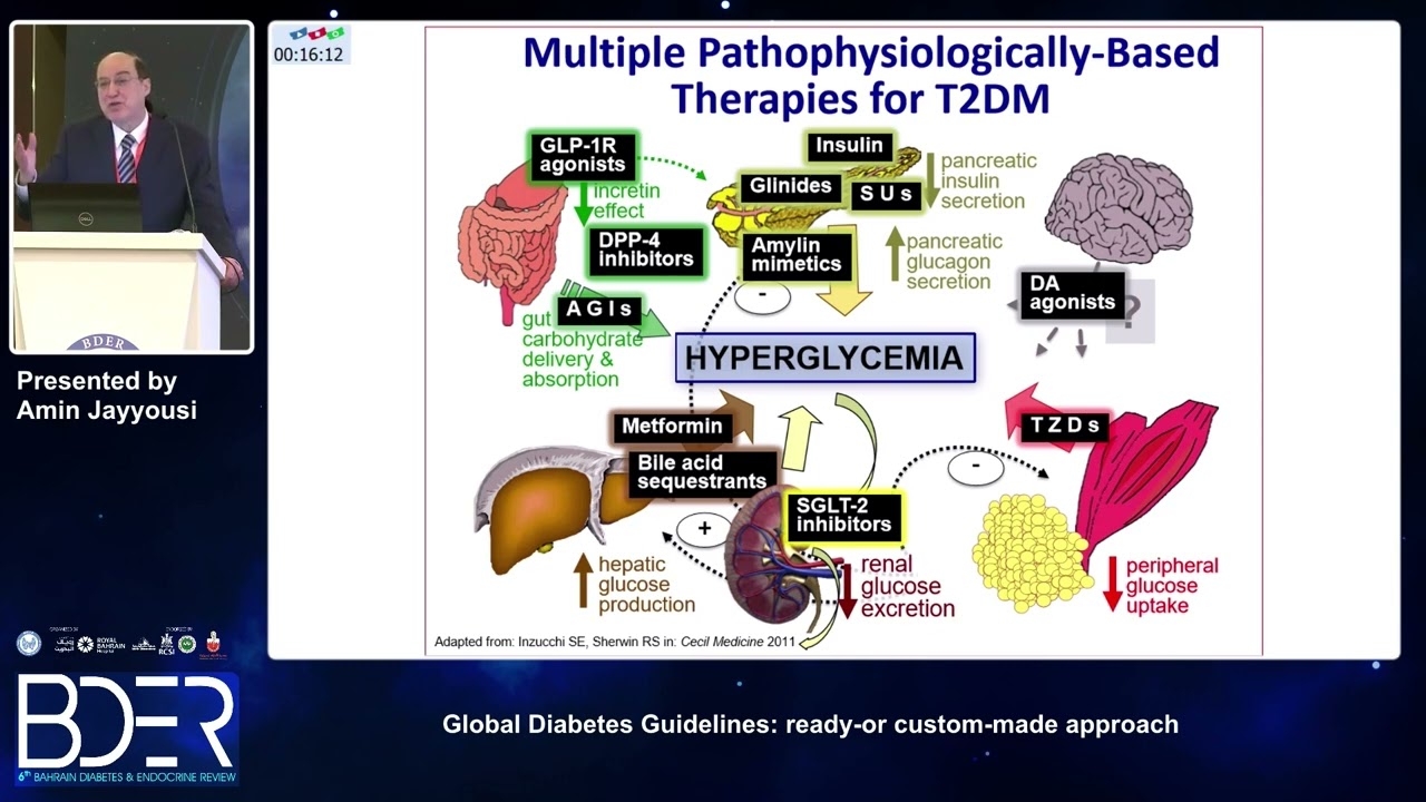 21  Amin Jayyousi   Global Diabetes Guidelines  ready or custom made approach