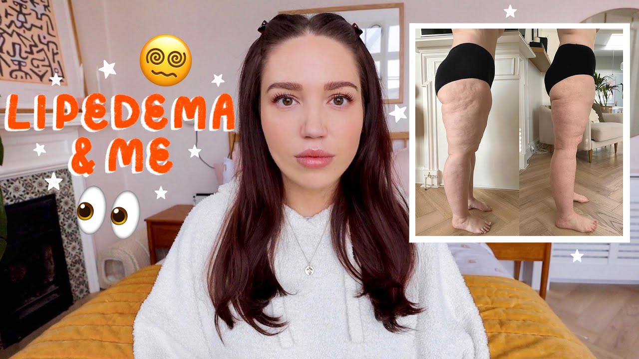 Липедема и я, эп. 1, реклама