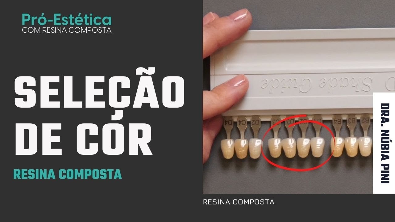 Como não ERRAR na SELEÇÃO DE COR da RESINA COMPOSTA
