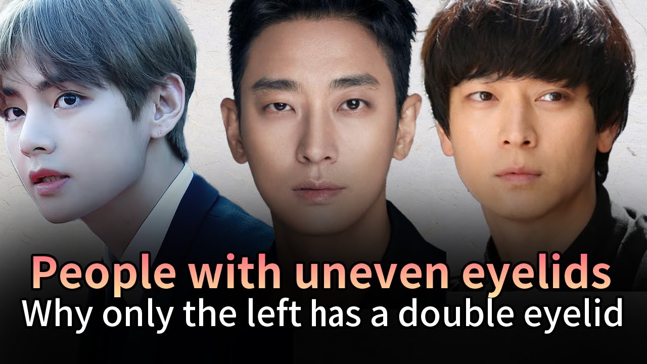 Why Is Only the Left Eye Double-Lidded? The Real Reason Behind Uneven Eyelids