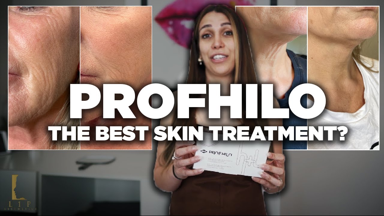 What is Profhilo? Does it actually Work?