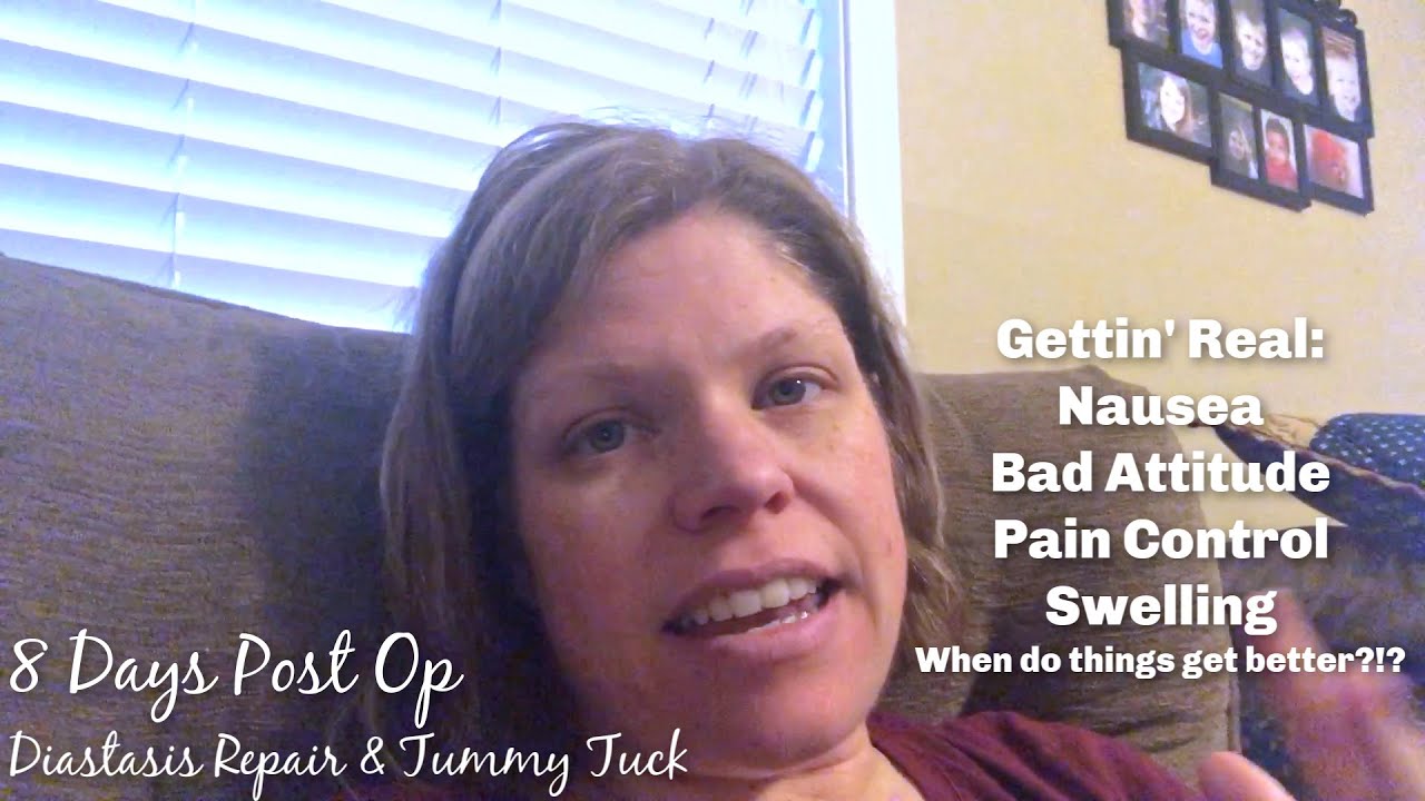 Diastasis Repair + Tummy Tuck - Day 8