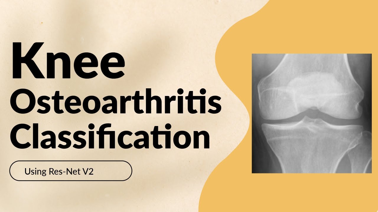 Обнаружение и классификация остеоартрита коленного сустава с помощью Resenet