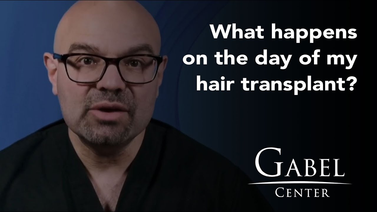 Hair Transplant Surgery Day | What to Expect | Dr. Gabel | Portland, OR