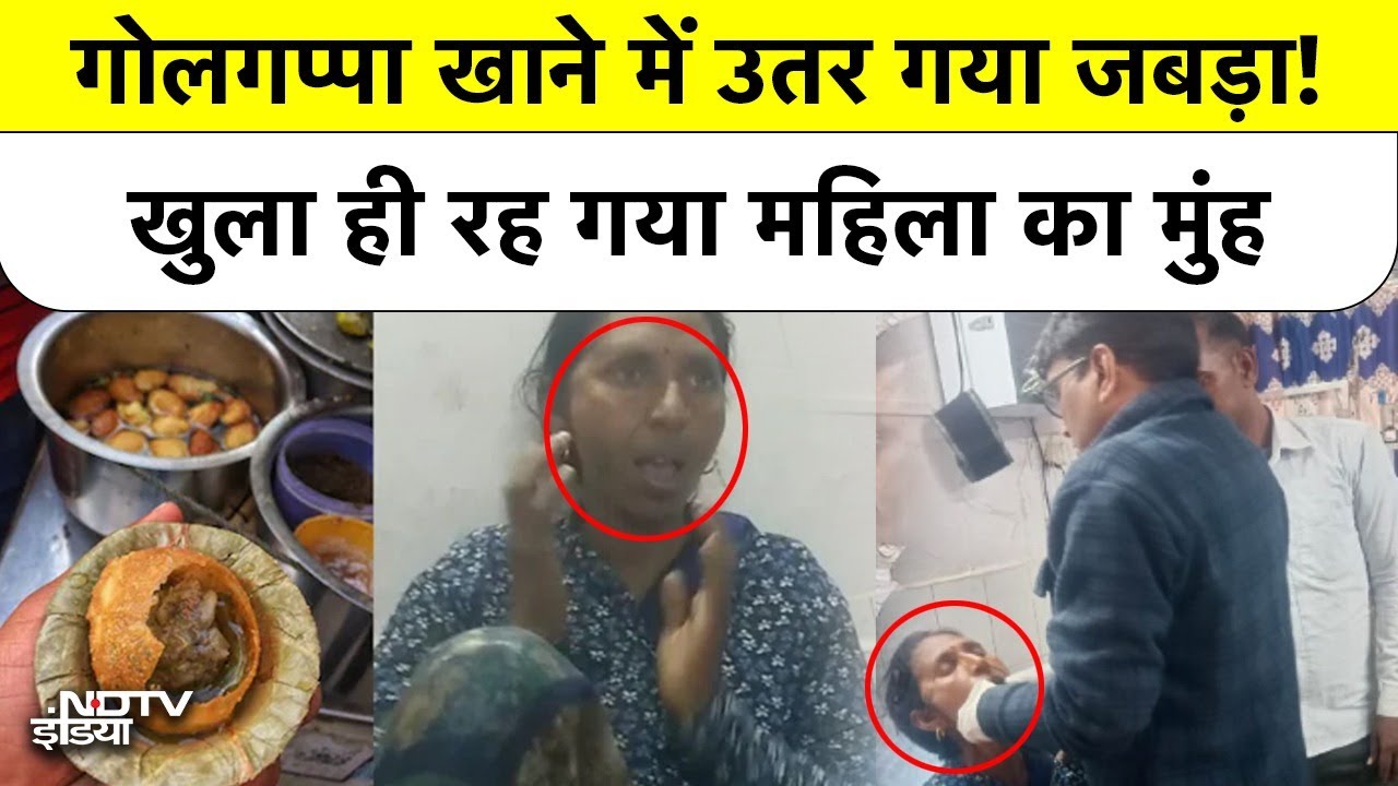 UP Auraiya News: गोलगप्पा खाते ही महिला का जबड़ा हुआ लॉक, डॉक्टरों के भी उड़े होश | Golgappa
