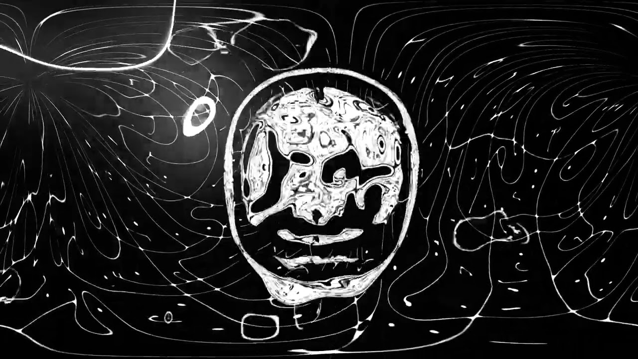MRI (МРТ)