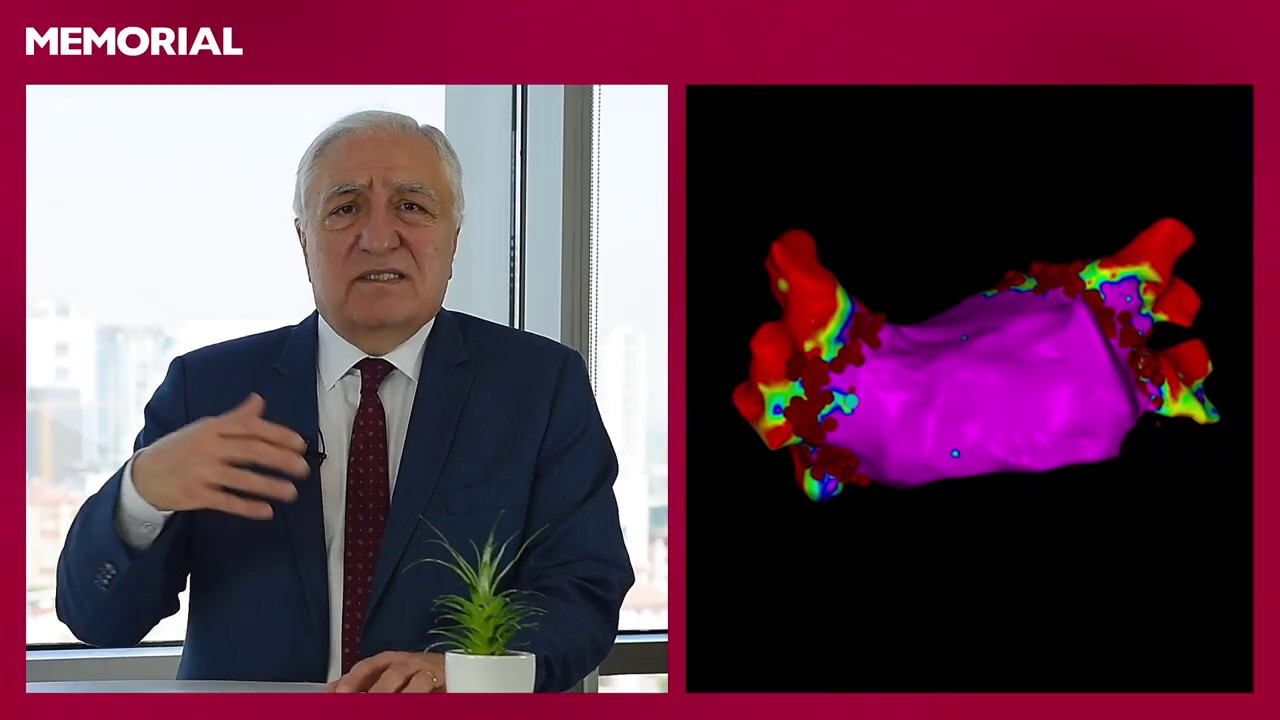 Kalp ritim bozukluklarında 3D haritalama nedir? - Prof. Dr. Ali Oto (Kardiyoloji)