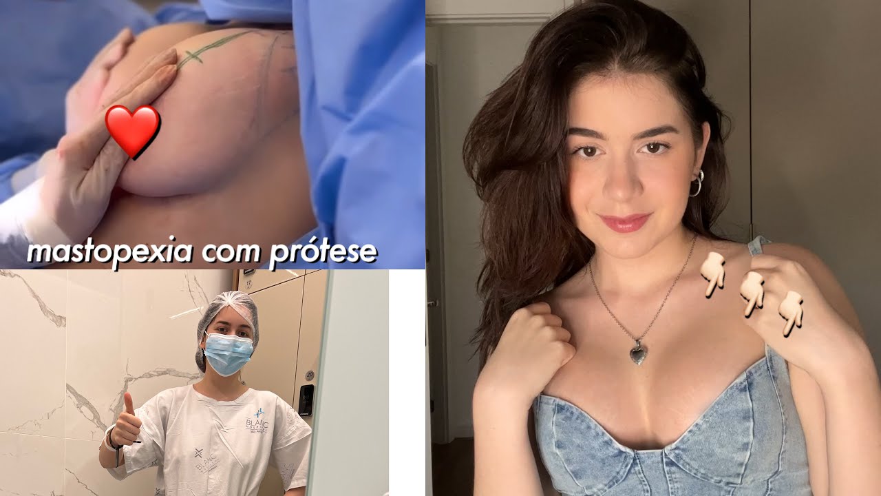 TUDO SOBRE O MEU SILICONE