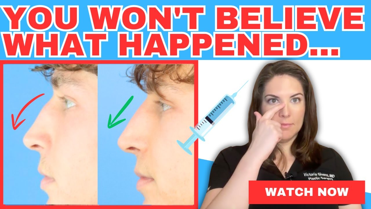 The Liquid Nose Job: Is It Worth the Risk?