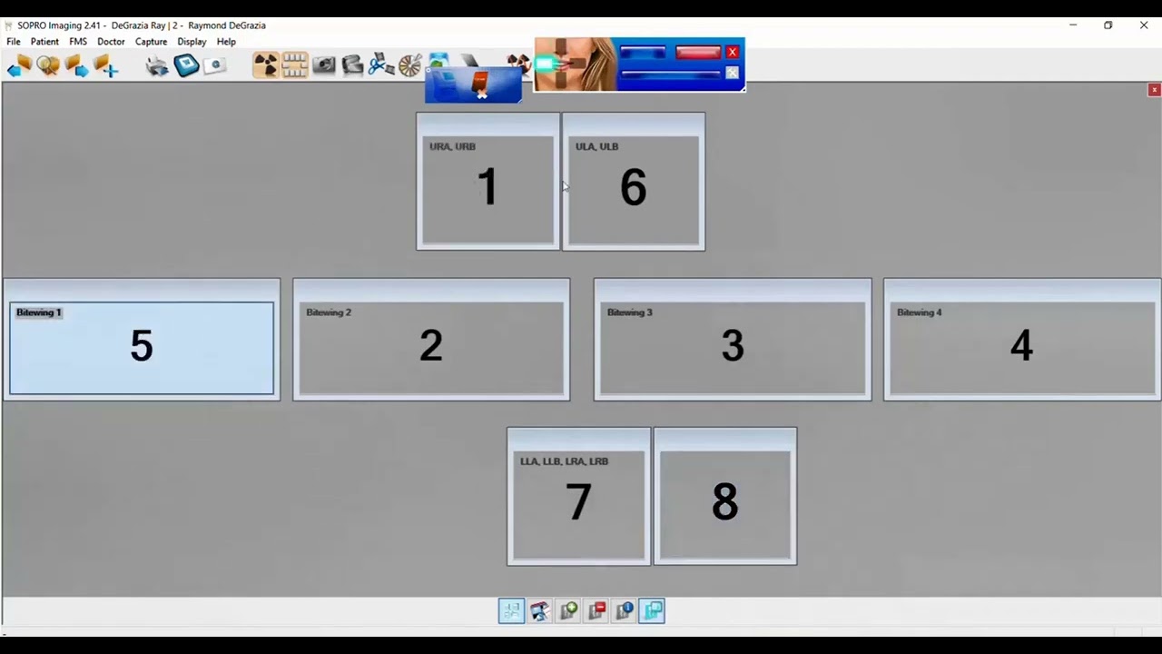 Setting up FMX Templates in Acteon's Sopro Imaging Software