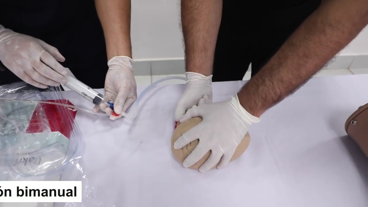 Manejo de hemorragia postparto con balones hidrostáticos Técnica Bakri