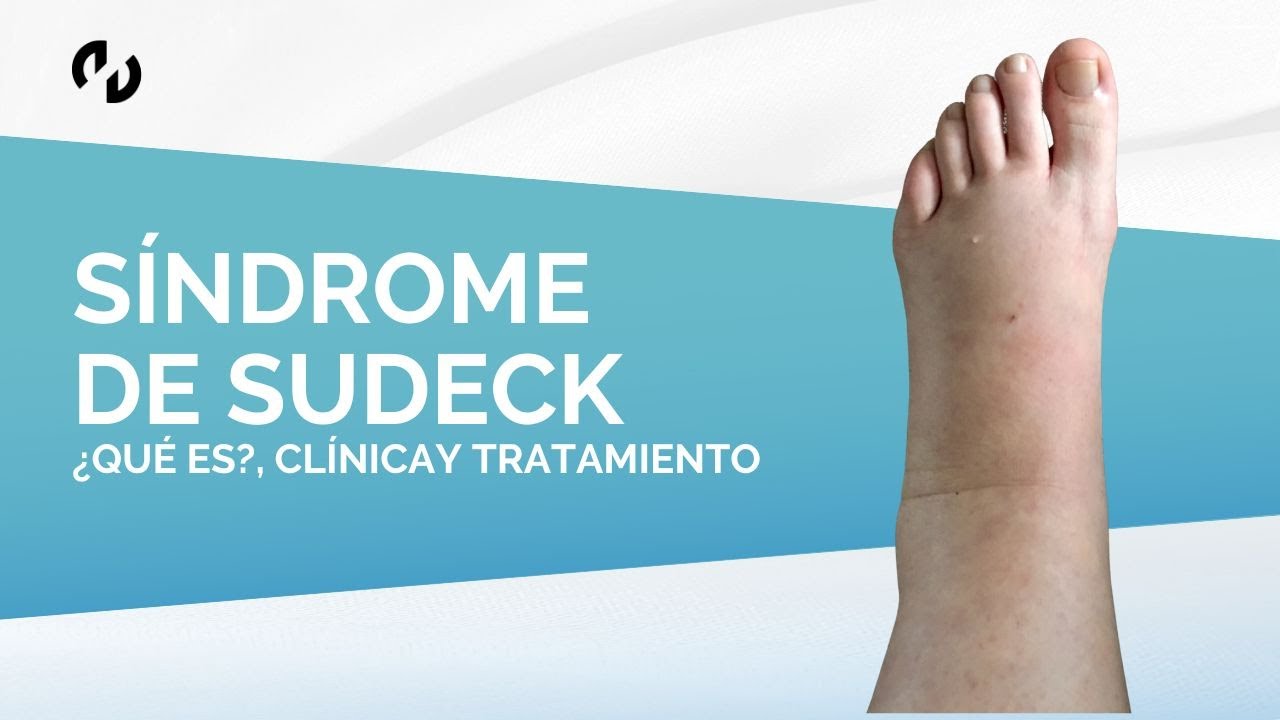 Síndrome de Sudeck: ¿Qué es?, clínica y tratamiento