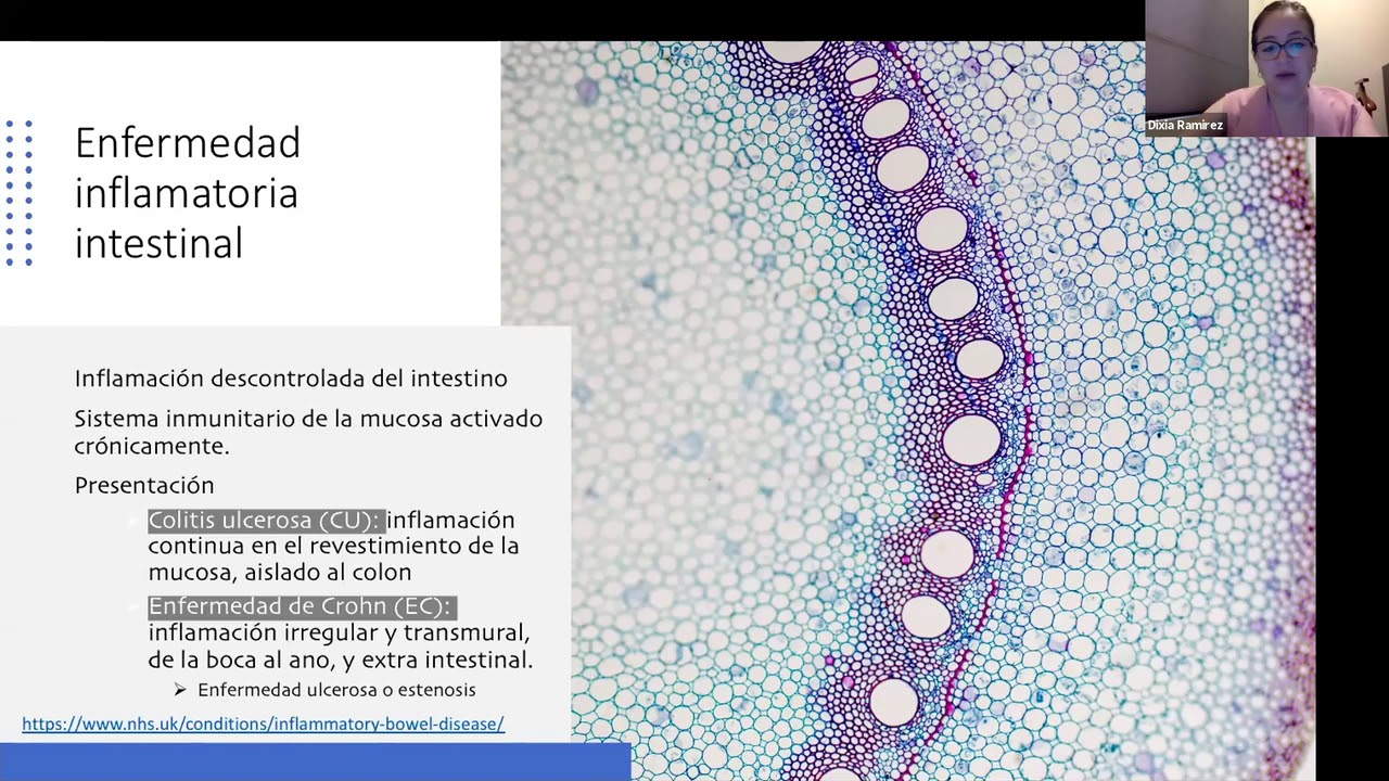 Terapia de Nutrición Integral en la Enfermedad Inflamatoria Intestinal