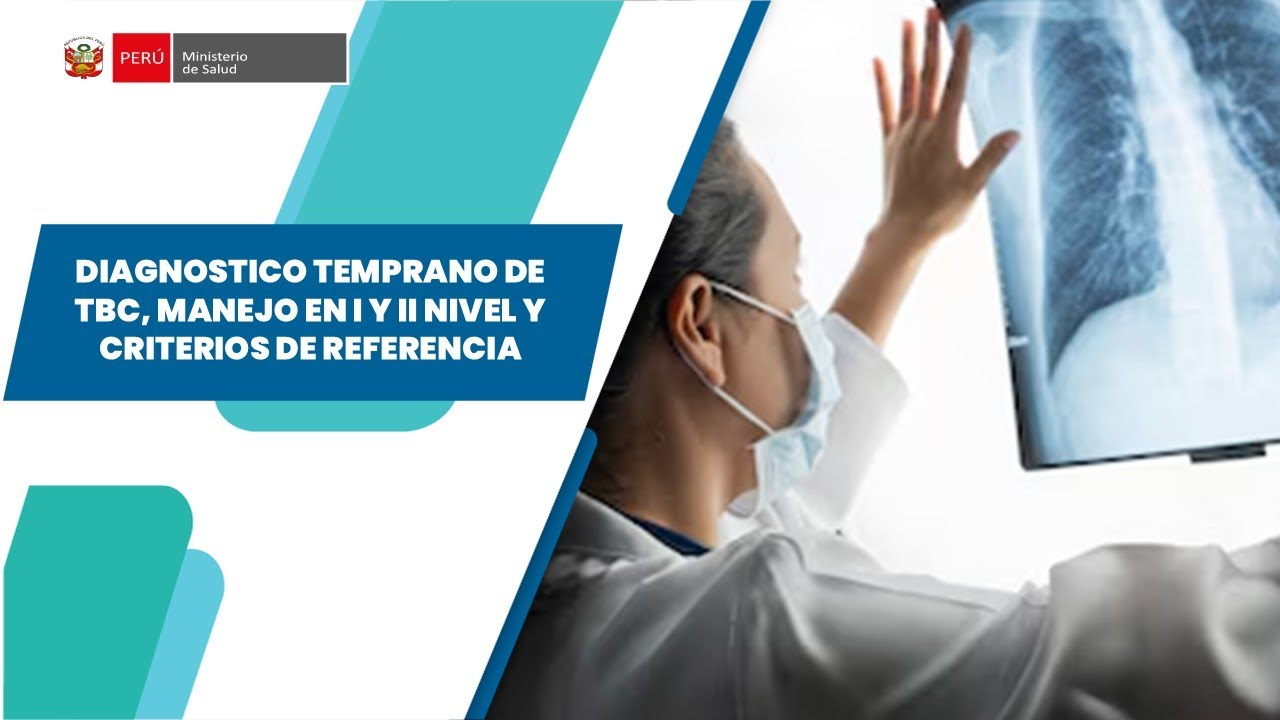 DIAGNOSTICO TEMPRANO DE TBC, MANEJO EN I Y II NIVEL Y CRITERIOS DE REFERENCIA