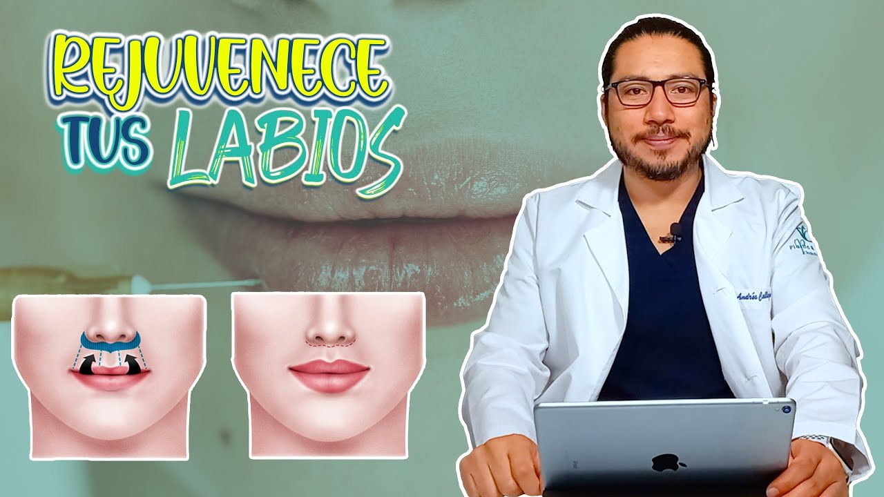 Rejuvenece los labios este 2023 - Dr. Andrés Callejas