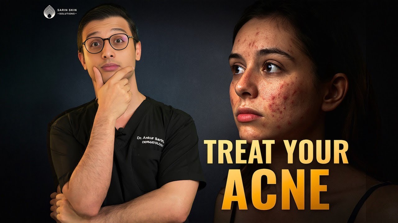 Acne treatment at home | Real Suggestions by a Dermatologist |