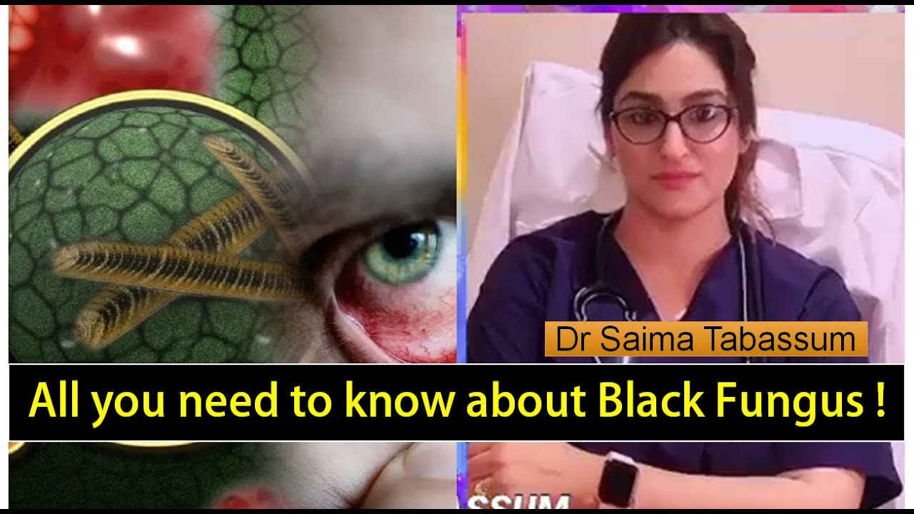 First case of Black Fungus reported in Jammu! What is Black Fungus? Dr Saima Tabassum explains