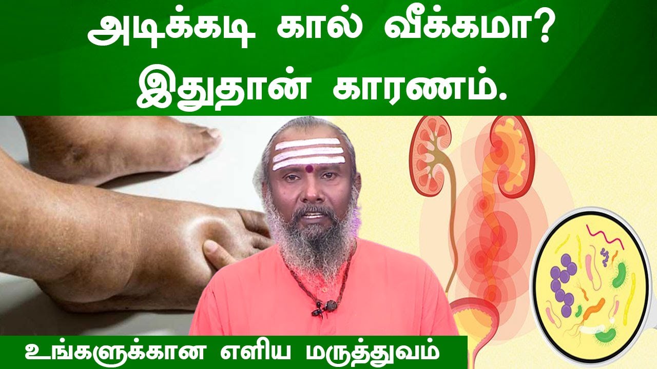 அடிக்கடி கால் வீக்கமா? இதுதான் காரணம். எளிய மருத்துவம் | Frequent foot swelling | mudakathan illai
