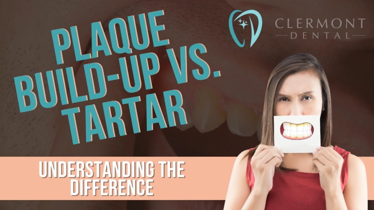 🦷 Understanding Plaque and Tartar: What You Need to Know | Clermont Dental Denver 🦷 #OralHygiene