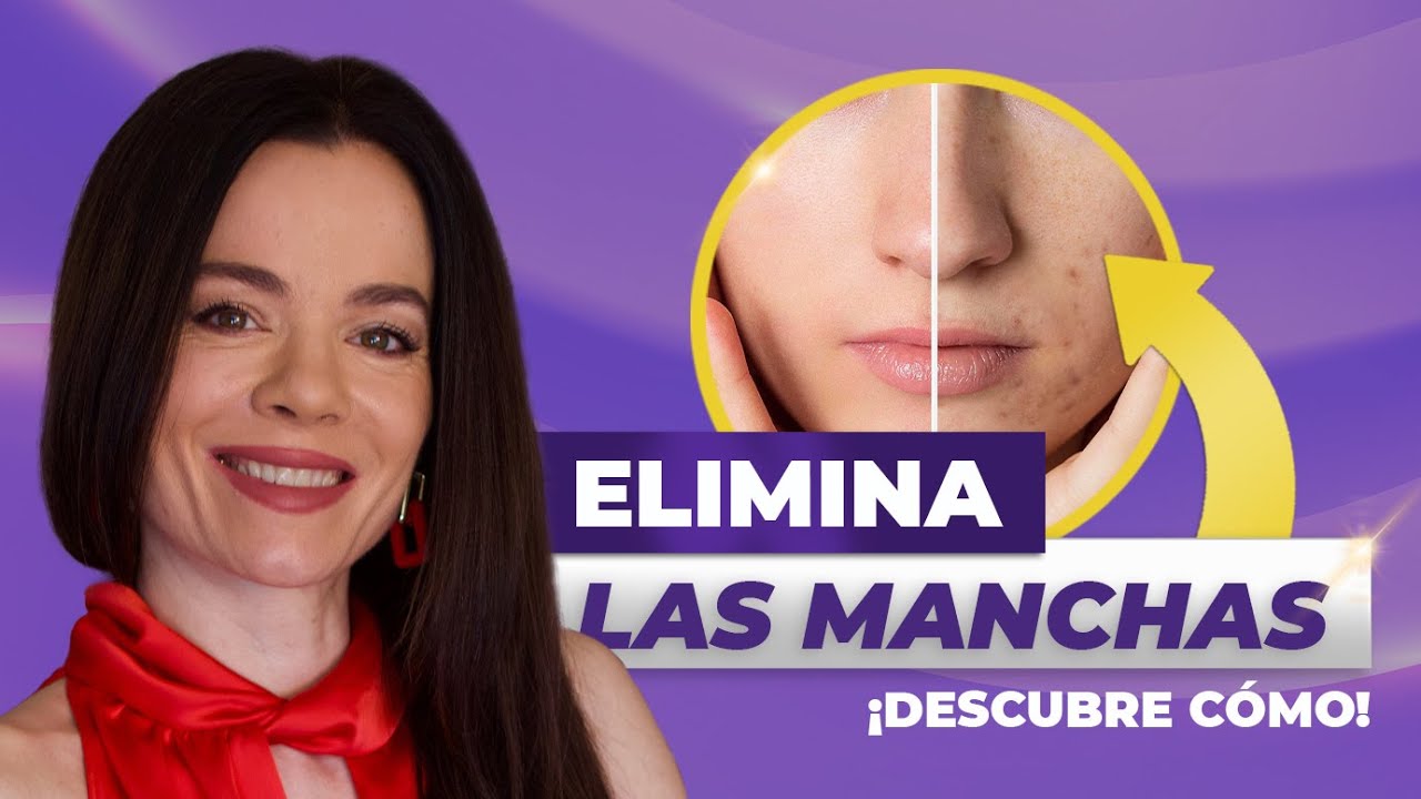 Descubre cómo tratar las MANCHAS EN EL ROSTRO 😍