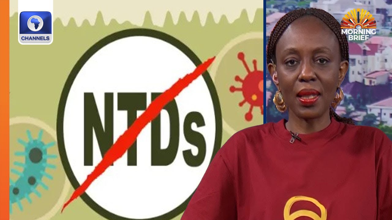 How Govt Can Tackle Neglected Tropical Diseases - Prof Joy Shu’aibu