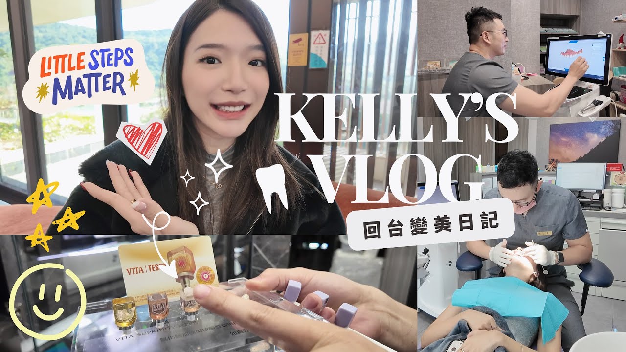 矽谷工程師回台vlog｜我回台灣「升級」了哪裡？花了六位數值得嗎？牙齒貼片全記錄！｜Kelly Tsai