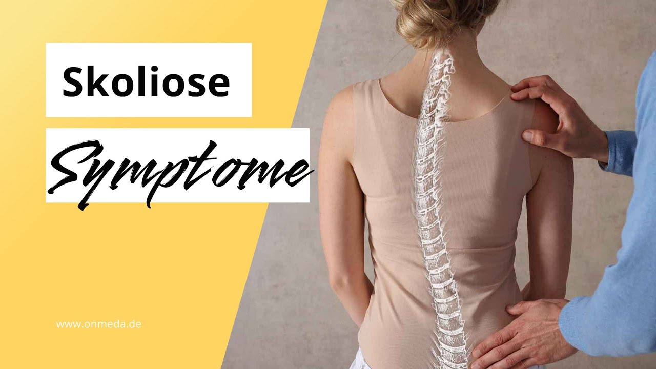 Skoliose-Symptome: 5 Anzeichen f&uuml;r eine Wirbels&auml;ulenverkr&uuml;mmung