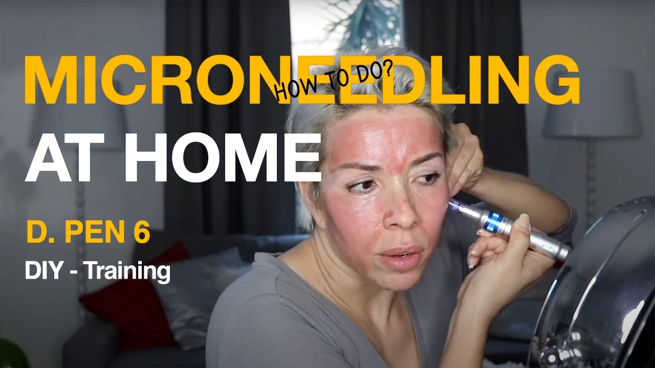 La mia esperienza di microneedling a casa con Dr. pen 6