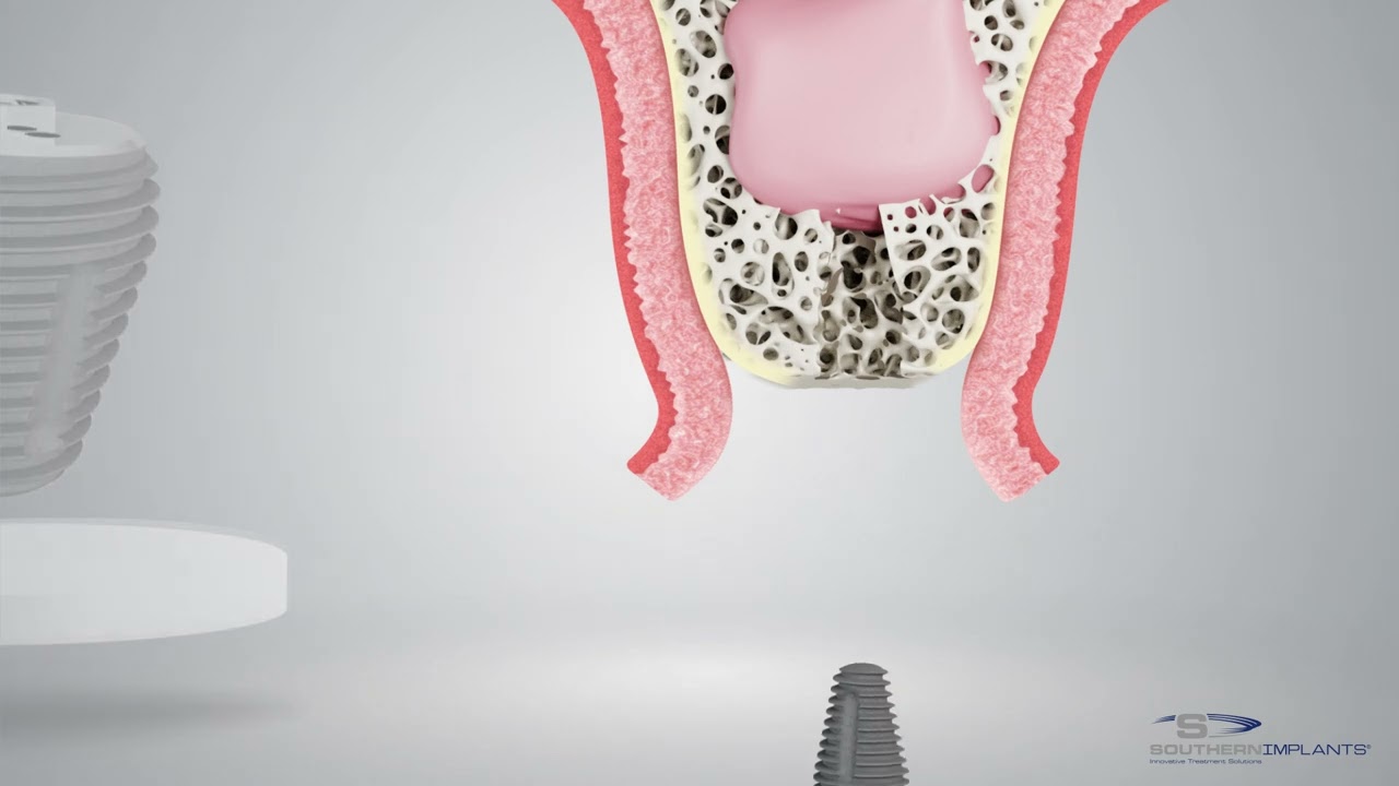 Concept MAX - Bénéfiques clefs de cette innovation