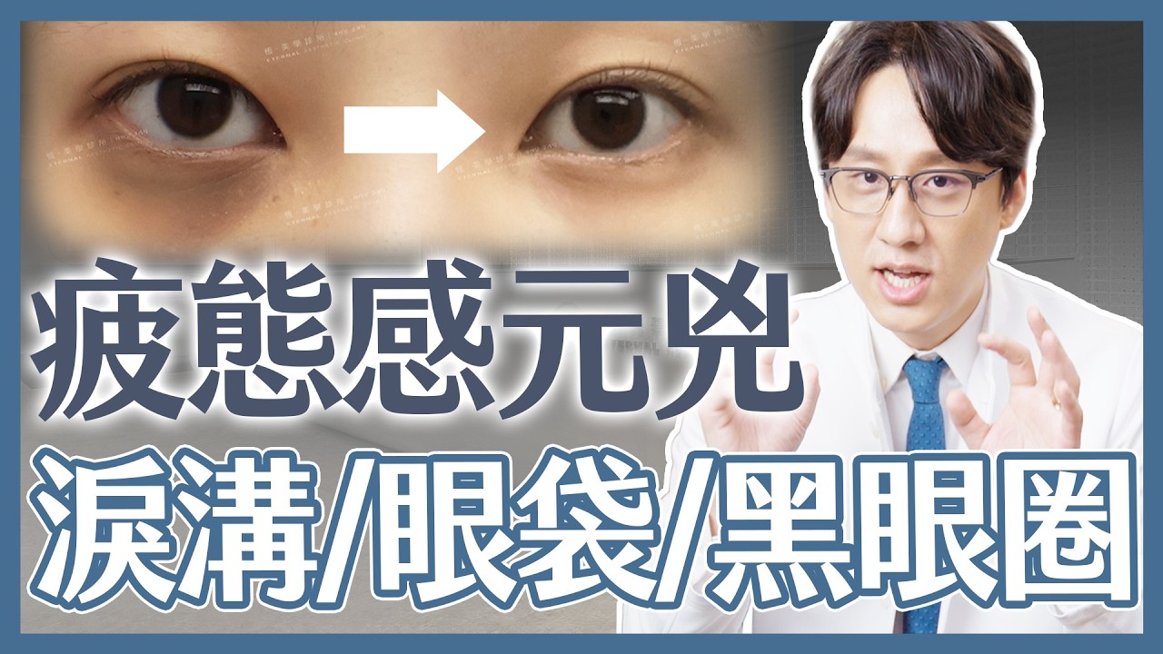 疲憊的眼袋、淚溝🐼該手術還是微整形⁉️聽聽歐巴醫師如何規劃