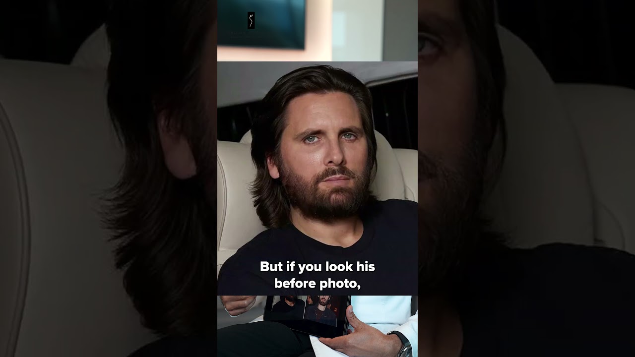 Scott Disick&rsquo;s Face: What We&rsquo;re Seeing and Why It Happens | Dr. Grover Weighs In