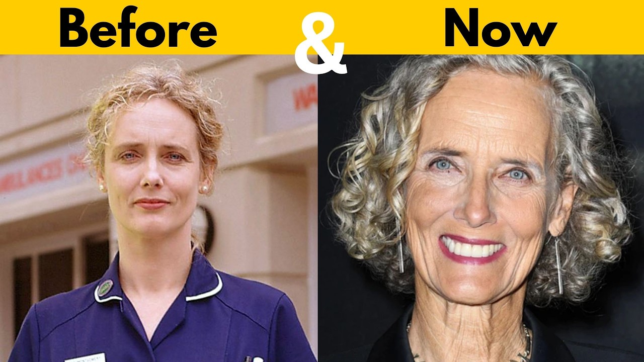 Casualty Cast - Before Vs Now